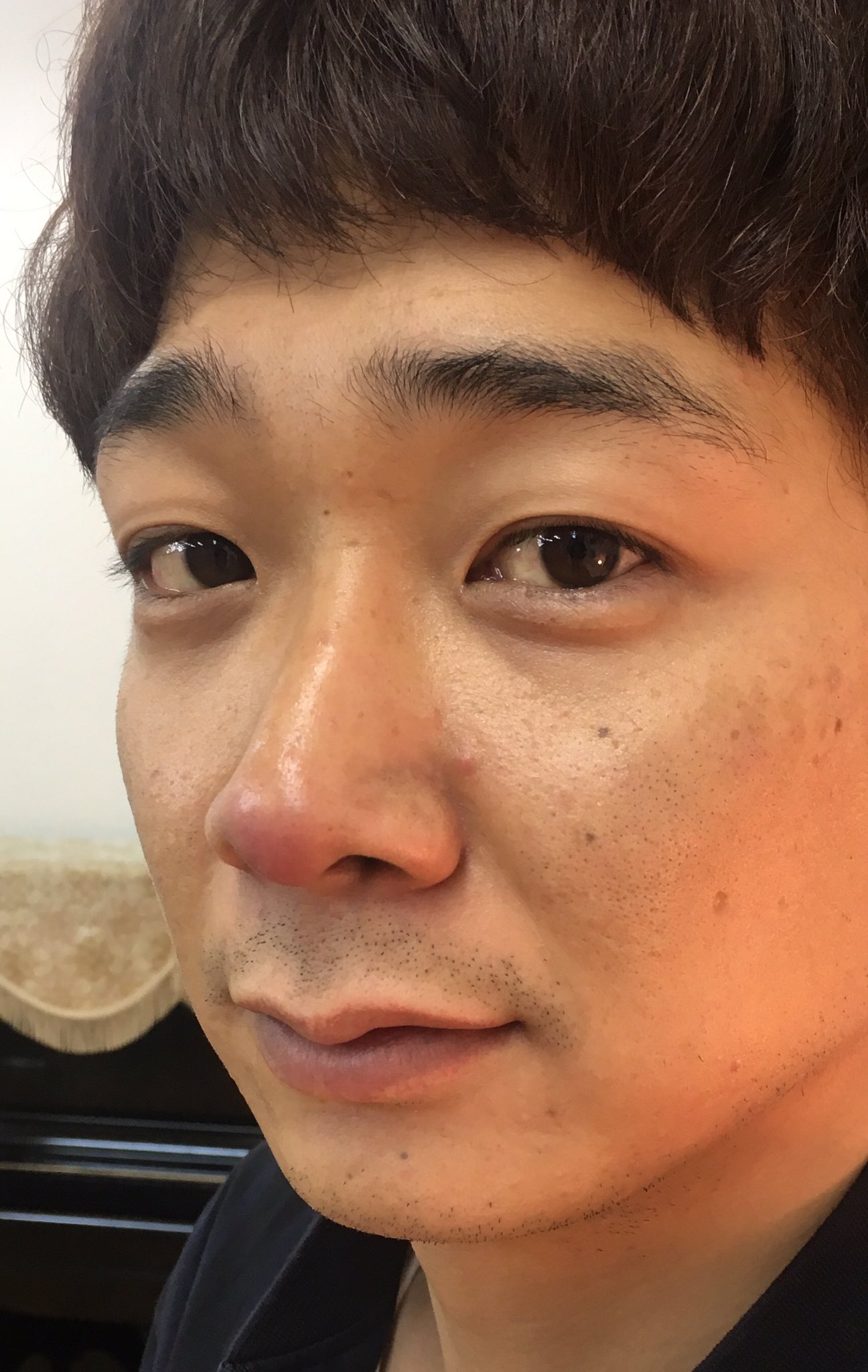 めんちょう写真 277441