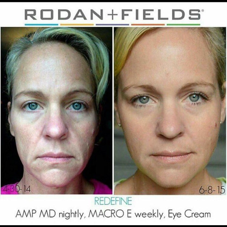 Wow! Why not you? #RodanandFields #skincare #wrinkleprevention