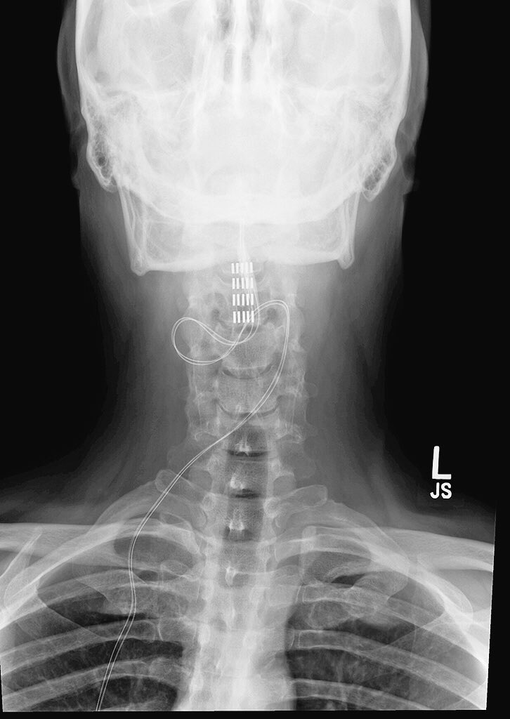 ChadBrodhacker's tweet image. @ArianaGrande #thankyou 4 #showinglove.plz read this page &amp;amp; RT if compelled gofundme.com/chadbrodhacker. #surgeryneed