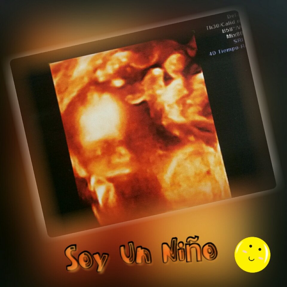 Dan_gerous0194's tweet photo. Eres mi motorcito para seguir adelante y luchar por esta pequeña familia👪
Te amo inmensamente mi pequeño!👶 https://t.co/svYTkPYhpa