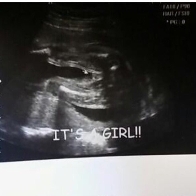 KennyGurrola's tweet photo. Leilani Romie Gurrola 👶🏽🚺🍼. Got me a little girl on the way. #SoonToBeDad https://t.co/2sbNx2UXtJ