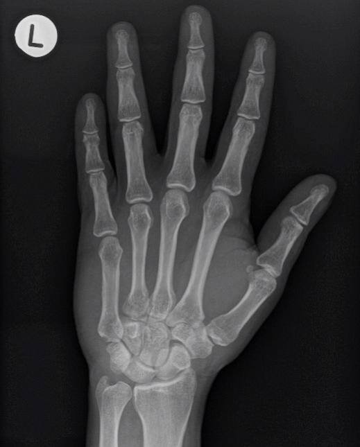 RadiologySigns tweet picture