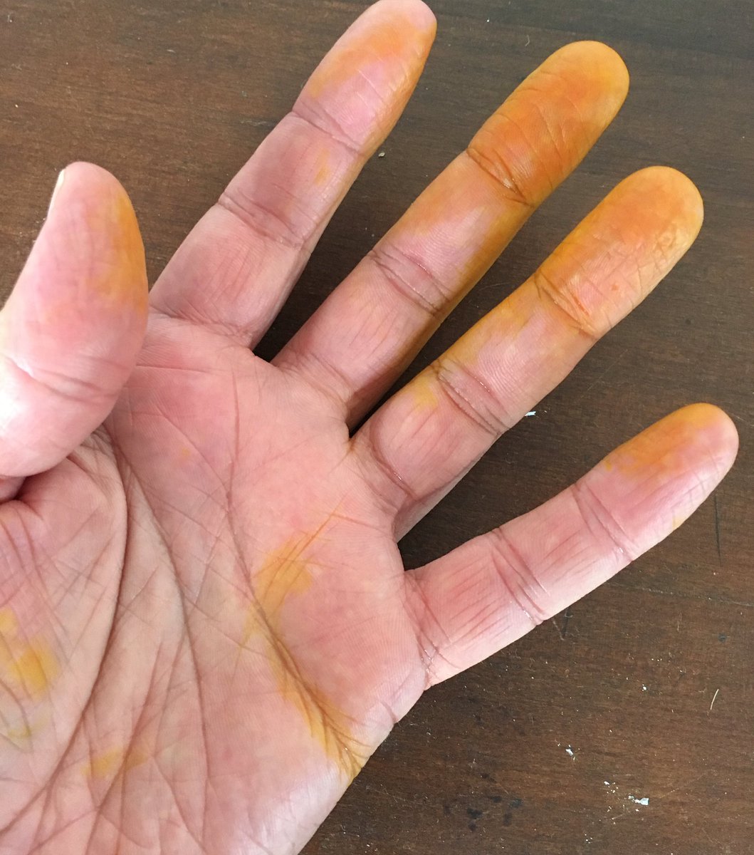 Rob2563's tweet image. Done a good job with that ink cartridge replacement today #NonGenuine #LearnHardWay #GoldFingers  #RobertDurrant