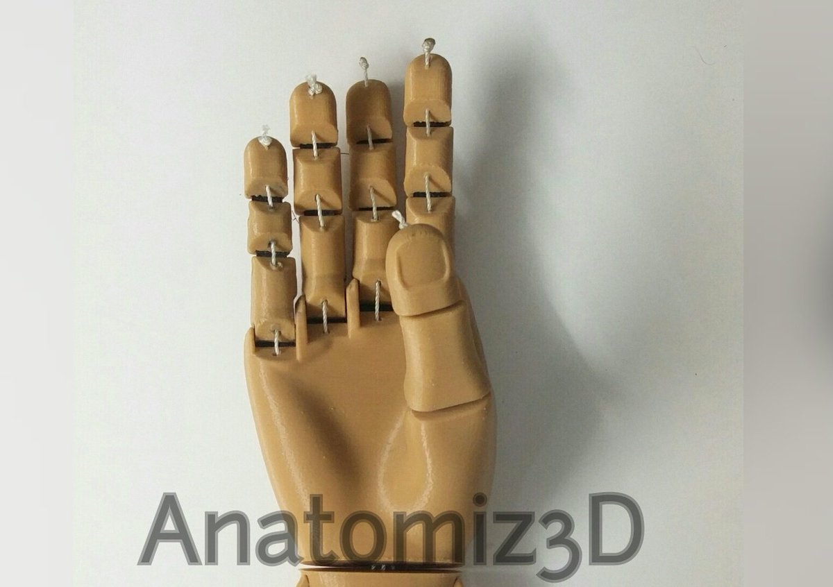 Anatomiz3D's tweet photo. #3dprinted #flexyhand #prostheses developed by @gyrobotuk printed in #India. #3dprinting #healthcare #3dprint #limb https://t.co/hL4NI8oMfp