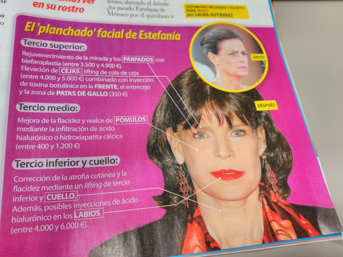 mirasemanal's tweet photo. El "planchado" facial de la Princesa Estefanía de Mónaco. Descubre con ¡Mira! cuanto cuesta estar como una princesa. https://t.co/a7CGVuxFg2