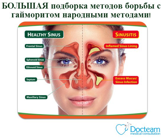 docteam_'s tweet photo. #Docteam #медицина
БОЛЬШАЯ подборка методов борьбы с гайморитом народными методами!
https://t.co/UxckJeSJdU https://t.co/q2tpnnurAq
