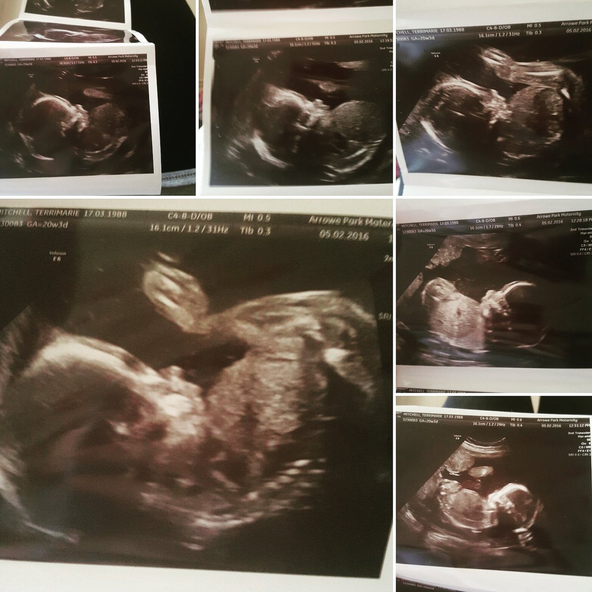 19terrie88's tweet photo. Baby bing due in June 2016 #love #mummytobe   @barabingwill https://t.co/21OmmDH22M