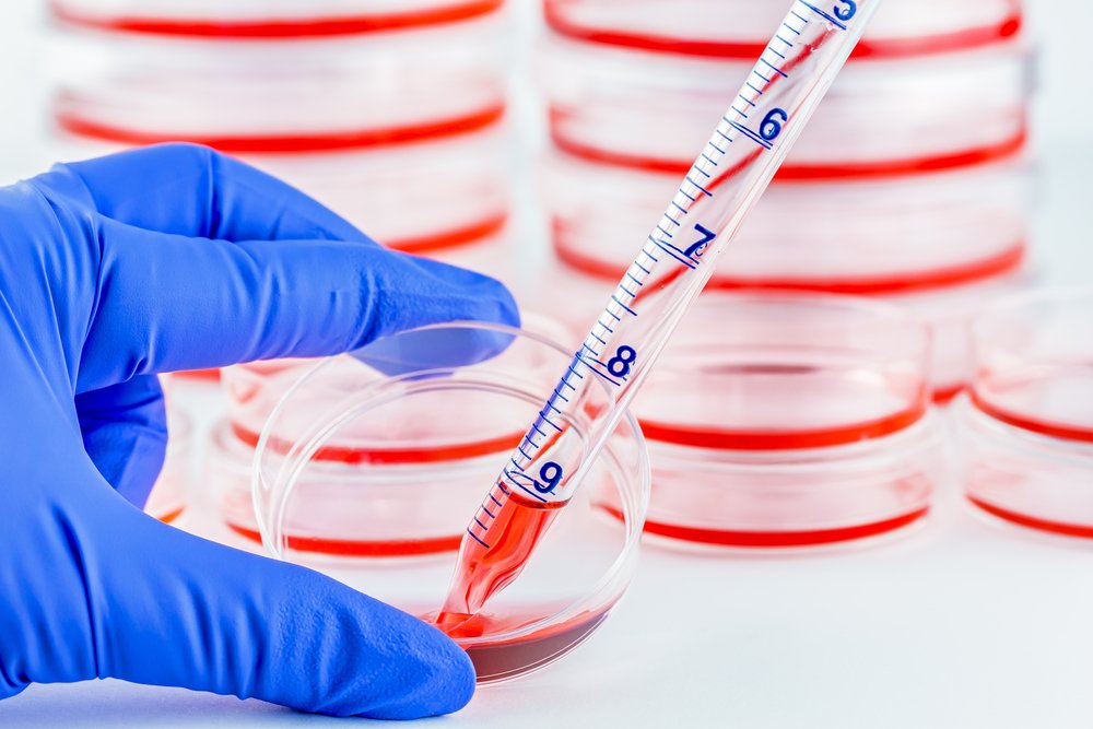 DiscoverMag's tweet photo. Stem cells offer hope for use as cancer treatment. https://t.co/6EkFiWcBpO https://t.co/DsYUtt3HgP