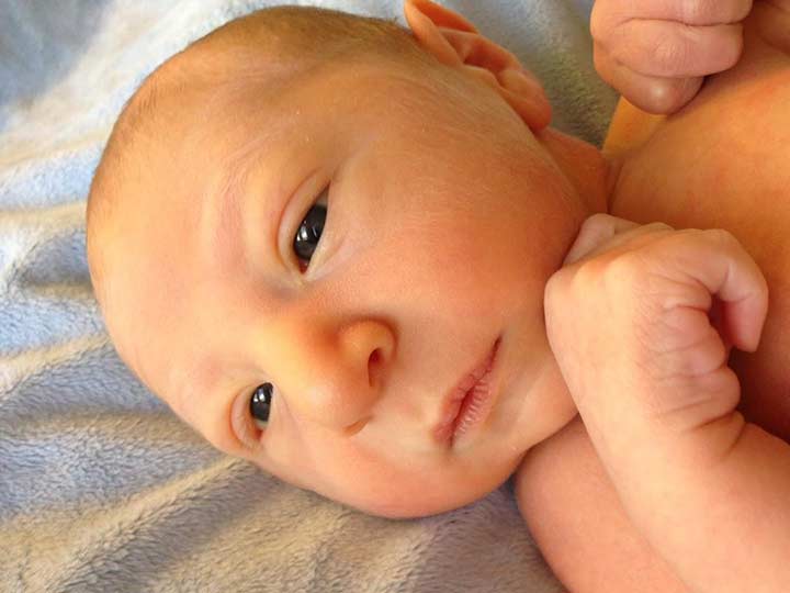 Родничок 1 год. Макроцефалияу новорожденных. Головка новорожденного. Врожденные пороки развития новорожденных.