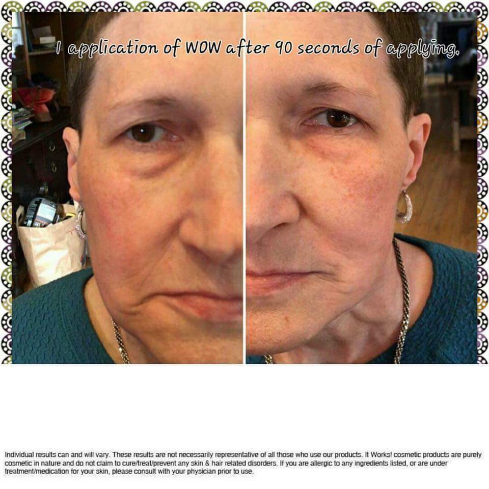 FireDream1118's tweet image. #oneapplication #wow #wrinkles #crowsfeet #buhbye