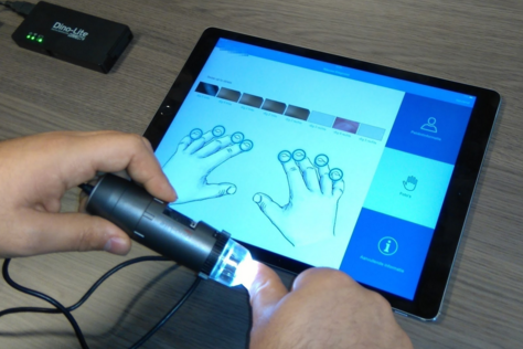 VipaHeldaBV's tweet photo. VipaHelda werkt aan een #App dat door gebruik van #Dino-Lite zeldzame huidaandoeningen signaleert #technology https://t.co/TTfAzxE94y