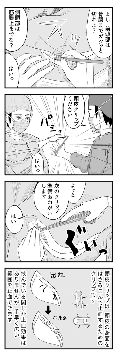 ブログ更新のお知らせ→ のうげかなう。 : はじめての開頭手術⑥ 頭皮クリップ(全8コマ) https://t.co/bhutckKfhY 