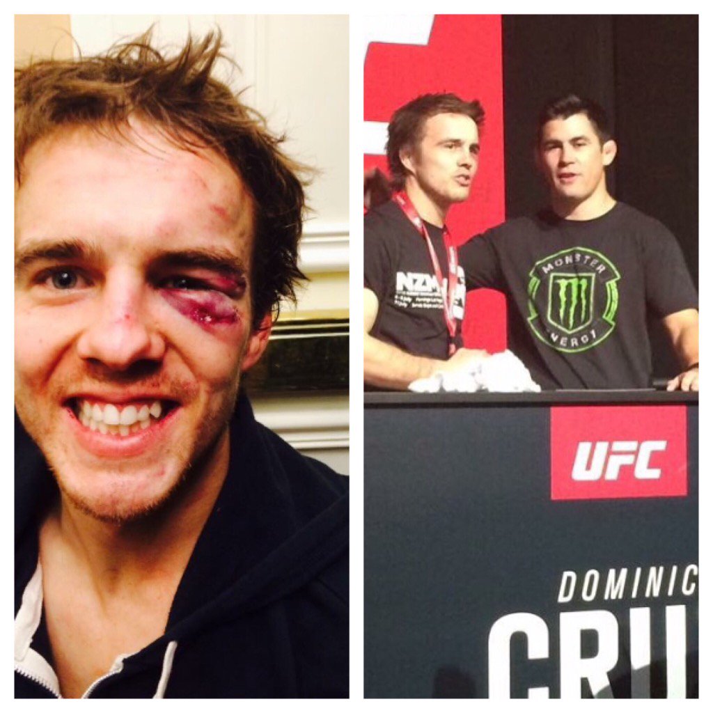 DoctorBray's tweet photo. @TheDomin8r remember this shiner when I meet you at UFC expo 😂😂 https://t.co/UxAqkD5t60