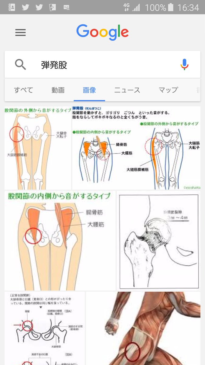 弾発股