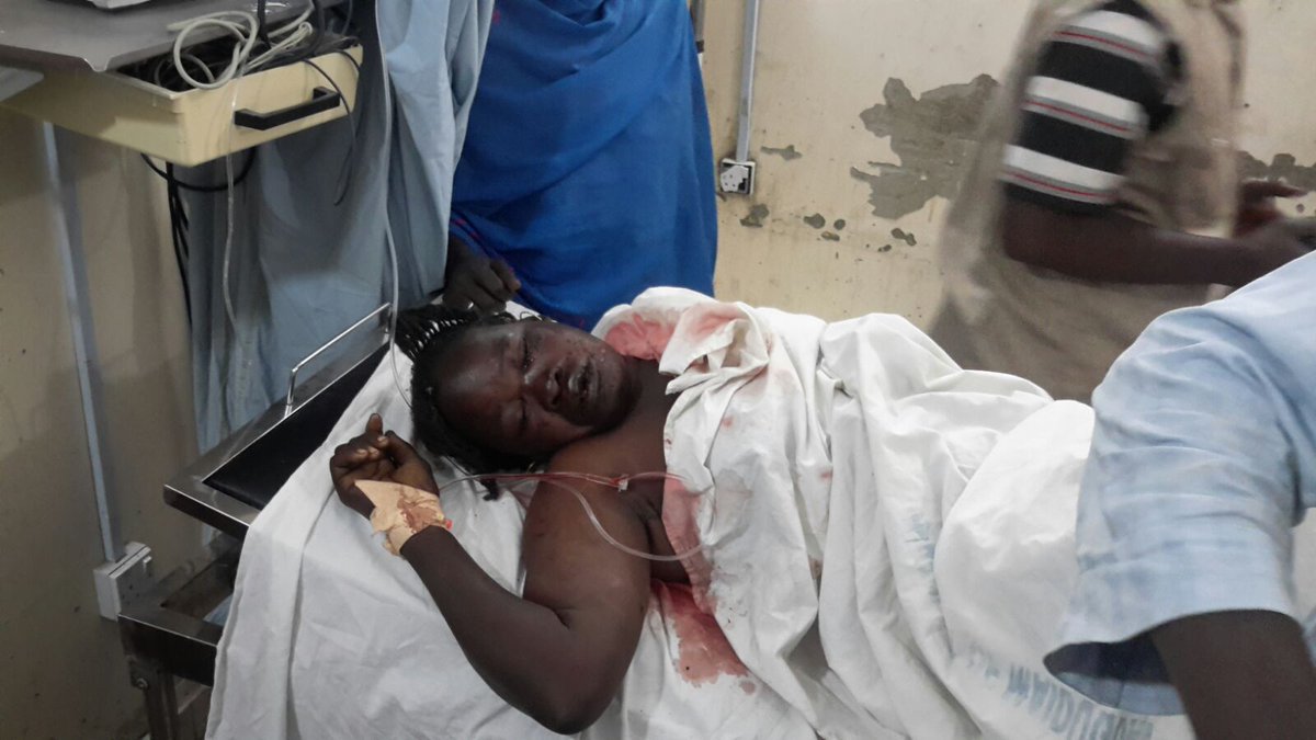 DanBorno's tweet photo. #Daloris injured victims, @ProfOsinbajo should come and see them since @MBuharus can't visit us @bz1wrts https://t.co/BdlB9QQATu