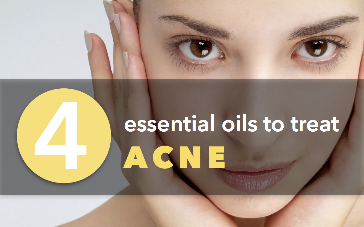 aveniroils's tweet photo. Here are the best essential oils for acne https://t.co/xuORiqvNmn https://t.co/MnpzpzMl8g