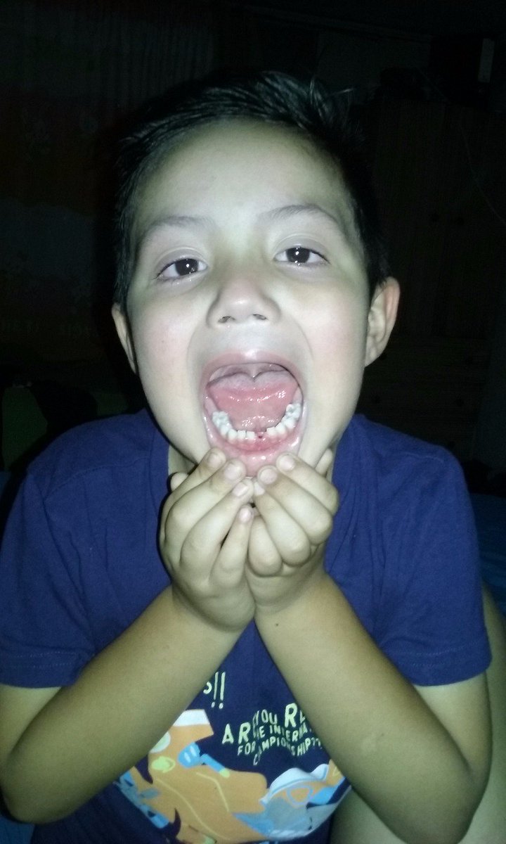 priscillaudax's tweet photo. su primer diente q se le cae a mi sebita te amo hijo https://t.co/xY4TfKuIo9