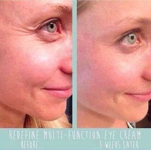 rodan and fields redefine eye cream