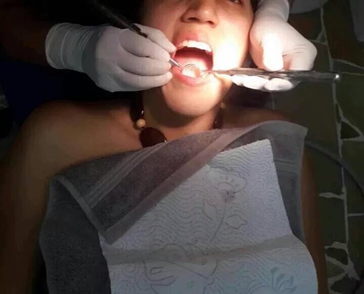 WorldSteticGye's tweet photo. Limpieza dental con #Ultrasonido solo en @WorldSteticGye aceptan tarjeta de crédito, separa tu cita @DrPeterValverde https://t.co/IgggiggdxZ
