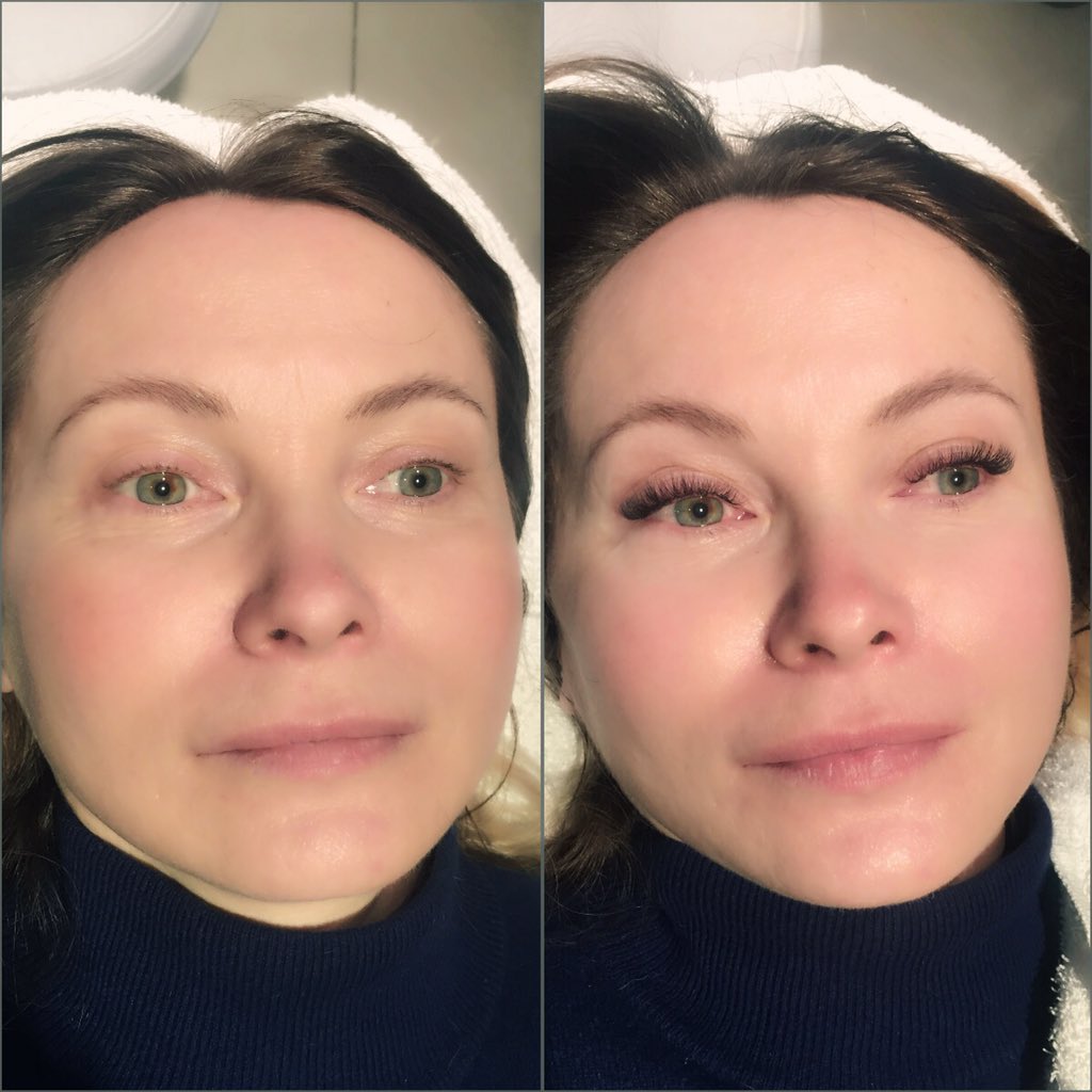 wickedblinksbyG's tweet photo. #beautiful Julia #beforeandafter #russianvolume #eyelash #extensions #nomoremascara #natural 2/3 D #lashes #Chelsea https://t.co/E5IC2WaAu8