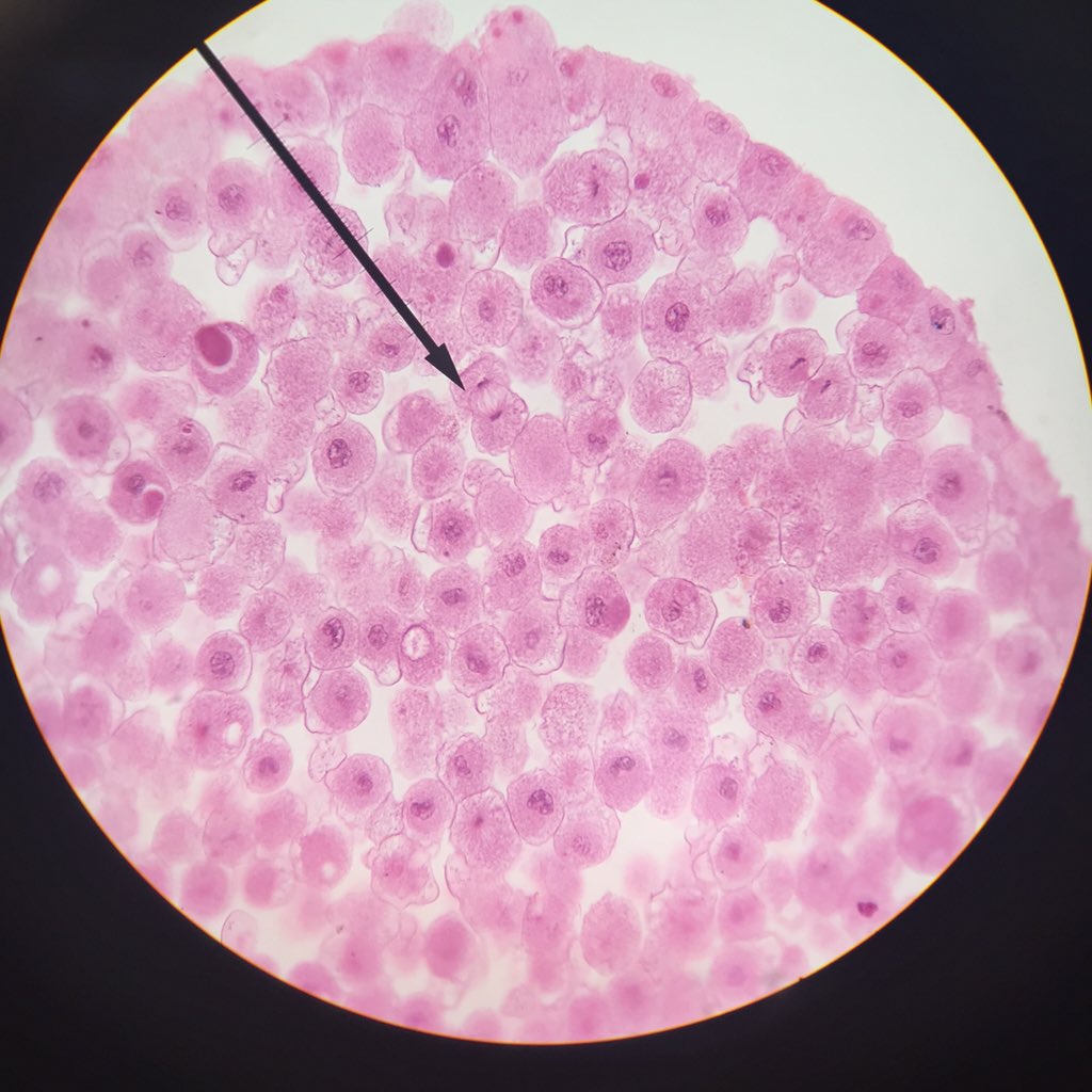 Looking at mitosis with <a href="/beswickbio/">Bridget Beswick</a> <a href="/Colls_HS/">Collingswood High School</a>  right at the tip of the arrow, this cell is going through telophase