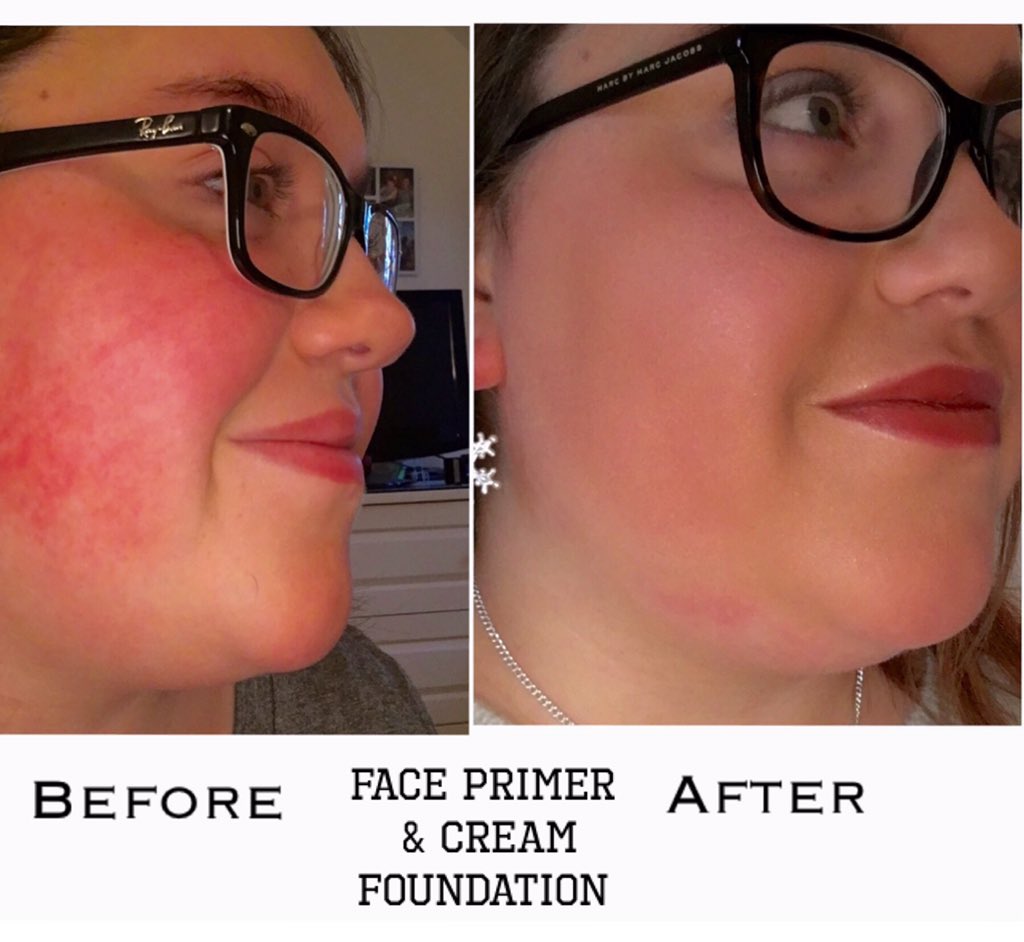 trulyyounique15's tweet image. Love foundation?? Why not try Youniques natural foundation! #amazingcoverage #flawlessresults #makeuplooks #gorgeous