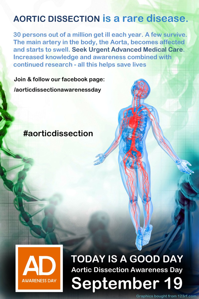 ADsept19's tweet photo. #aorticdissectionawarenessday #posterproposal #aorticdissection #september19 @AorticAwareness @RareDiseases https://t.co/bIrxe4grwt
