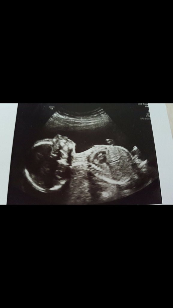 ChloeEliz96's tweet photo. Little man needs to hurry up now!!!! https://t.co/5S0VgZ19XK