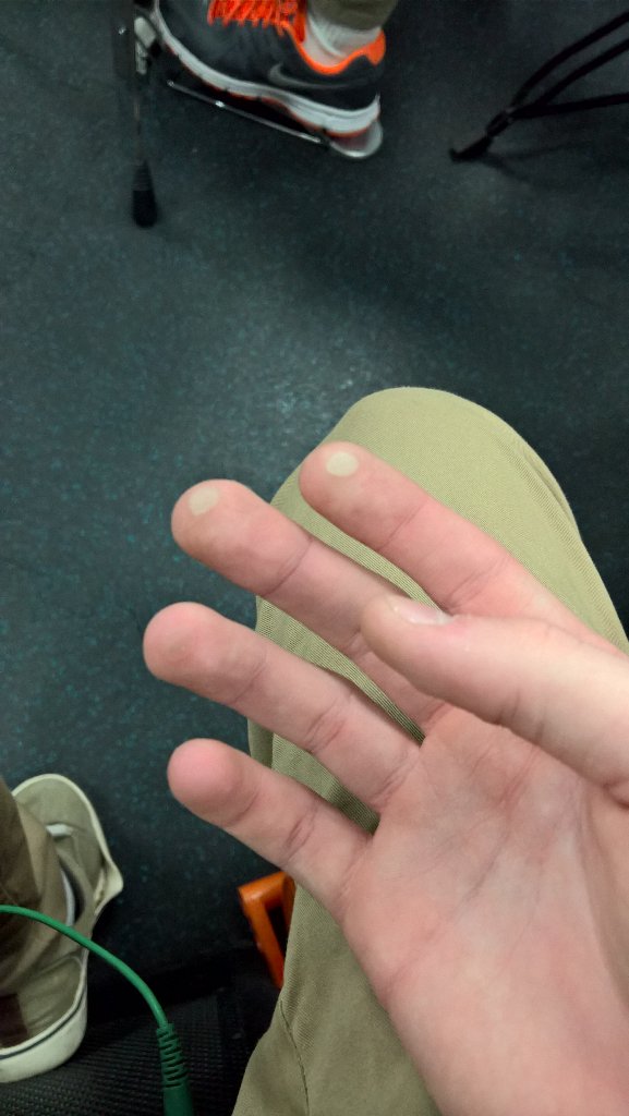 TangibleOrange's tweet photo. When you hit the bass too hard for too long. RIP my fingers :( https://t.co/EMTPxrMgCA