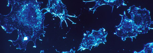 Mejoran detección del cáncer con un microscopio miniaturizado buff.ly/1SgktOr