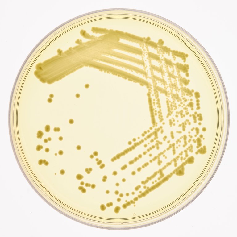 NASAAmes's tweet photo. What else will be on @NASA_SLS's first flight? Our BioSentinel, growing yeast in deep space #RideOnSLS https://t.co/CXQjg62c8H