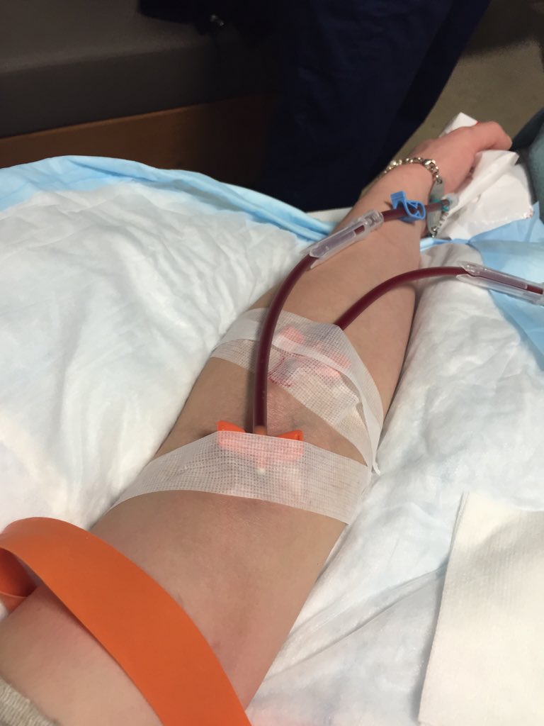 rachelengler's tweet photo. The things #spoonies are thankful for - double stick success today! #Fisty #myastheniagravis #PLEX #notfortheweary https://t.co/gjpaGh5shK