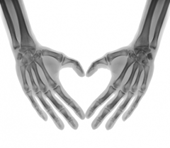 Nutralliance's tweet photo. Quercetin may promote bone formation by modulating gene expression linked to increast osteoblast activation! https://t.co/n0Xl0bUHIF