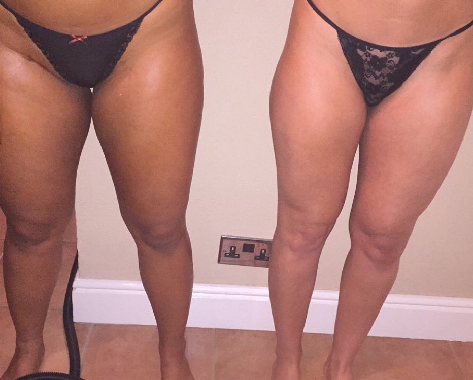 SimonaTanning's tweet photo. 2 happy clients after their spray tans! #Medium and #Dark ✨☀️👙 #SpringTraining #MiltonKeynes #MobileService https://t.co/VTVYfZ4l70