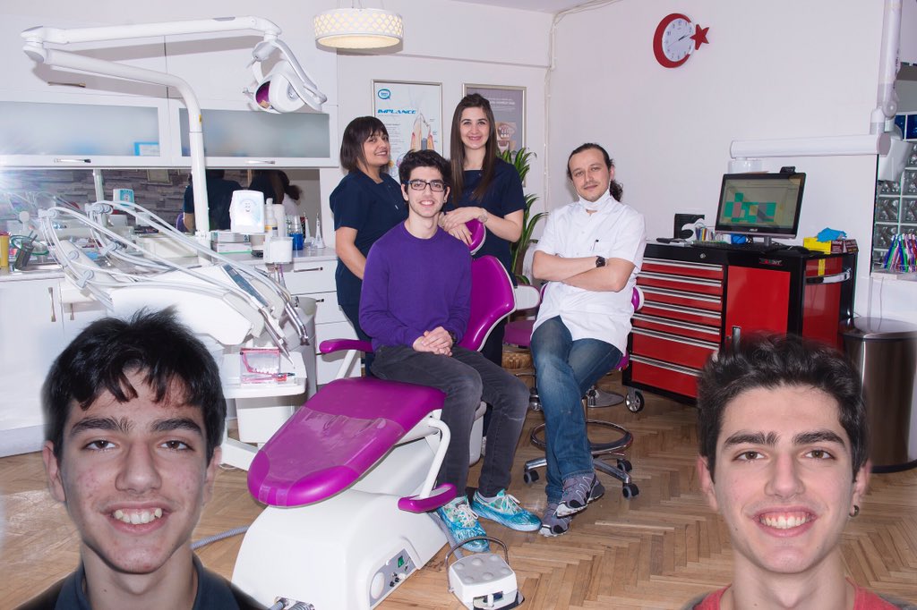 Artık gülerek gülümseyen bir hastamızın ortodonti tedavisi öncesi ve sonrası
alpdent.net