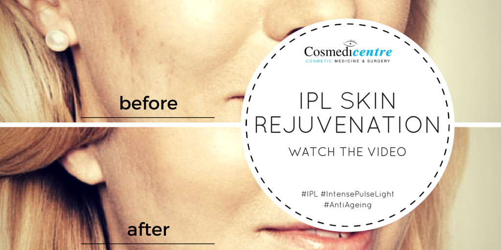 Cosmedicentre's tweet photo. Find out the benefits you can achieve from our IPL Skin Rejuvenation treatment. https://t.co/kJcYNKwWI6 #IPL https://t.co/s5TkWC5ZcW