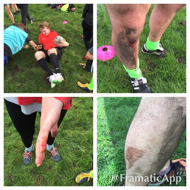 ianhayne's tweet image. A "friendly" game of touch rugby they said... #WeAllMove #Limeysaretoocompetitive #rugby