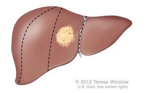 National Cancer Institute tweet media