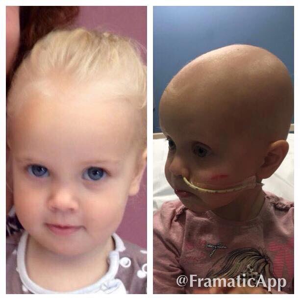 rubylaurayoung's tweet photo. Well done &amp; thank u @Daily_Star for making the disappointing storyline on @itvcorrie headline news! #neuroblastoma X https://t.co/Qnlwa76Qe2