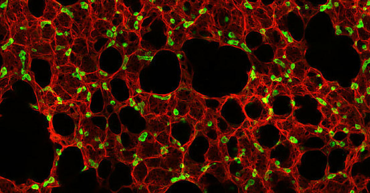 AmericanCancer's tweet photo. We've funded researchers who are investigating changes in cells that lead to #lungcancer: https://t.co/pt7Z5geU6M https://t.co/hQPOBkLZbK
