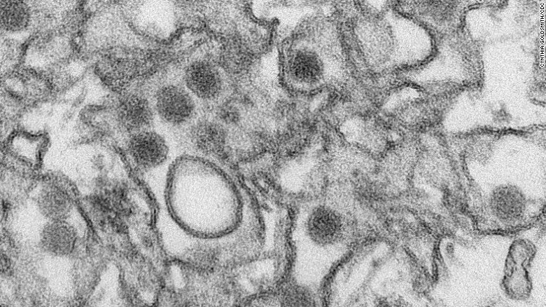 .<a href="/drsanjaygupta/">Dr. Sanjay Gupta</a> answers your questions about sexually transmitted #Zikavirus cnn.it/1nI7pUw