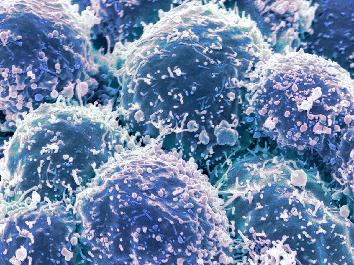 MobilePunch's tweet photo. #WorldCancerDay: Early warning signs of cancer https://t.co/MwfYaHR76I https://t.co/qpfo9Badut