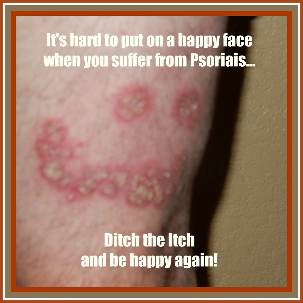 US_LaBeautePure's tweet photo. We can help! https://t.co/CvTxpznSq0 #GetHappy #PsoriasisPsucks #DitchtheItch #TameTheFlame https://t.co/2SjQVOBugR
