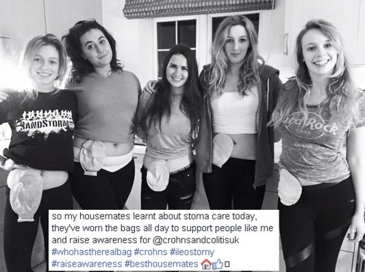 GetYourBellyOut's tweet photo. Thank you Anna for sharing your lovely #GetYourBellyOut photo with us! @CrohnsColitisUK https://t.co/1Tmcj0EvbJ
