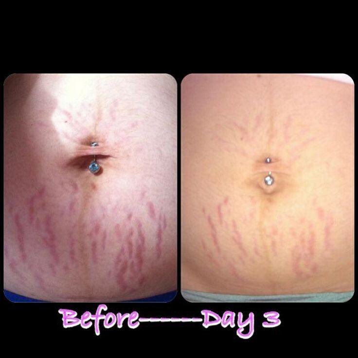 makeupbykerrie's tweet photo. Just look at these gorgeous results using #uplift and #divine combined! #Younique #beauty #skincare #love #botox?? https://t.co/6a070R6ugC