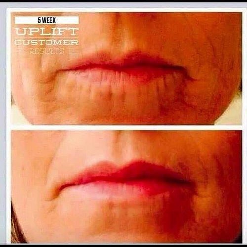 makeupbykerrie's tweet photo. Just look at these gorgeous results using #uplift and #divine combined! #Younique #beauty #skincare #love #botox?? https://t.co/6a070R6ugC