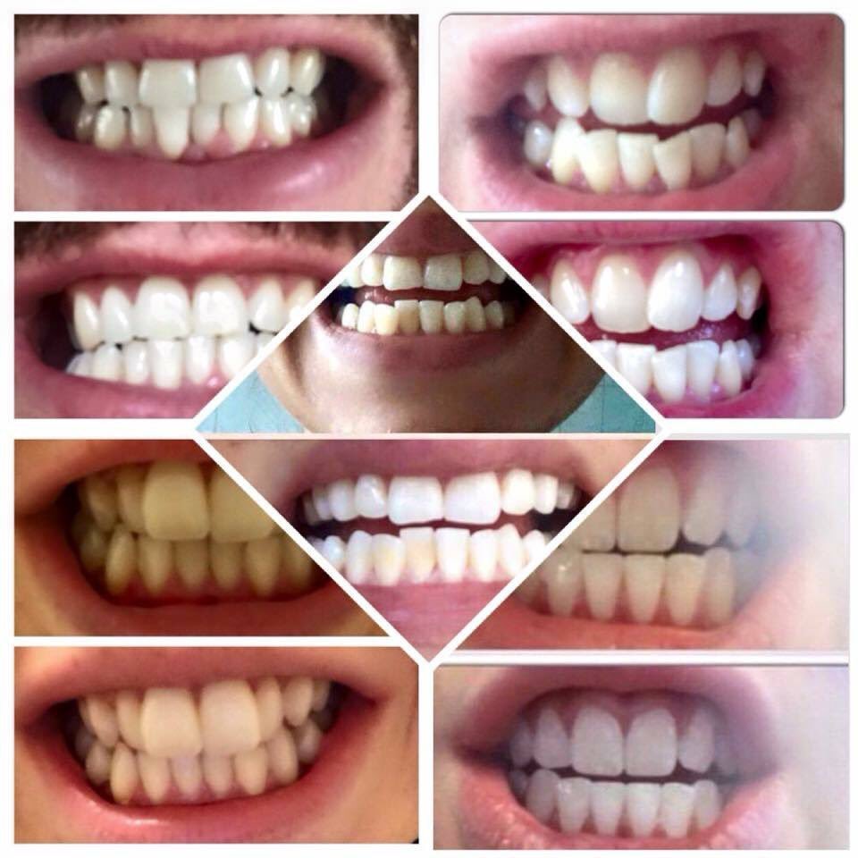 BeauteClare's tweet photo. #hollywoodsmile #whiteteeth #toothpaste #fab https://t.co/n7CowYShqH
