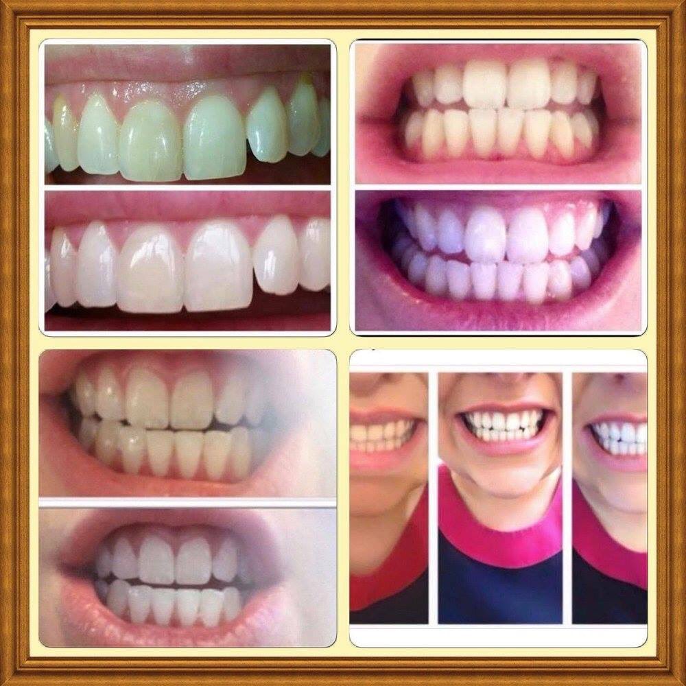 BeauteClare's tweet photo. #hollywoodsmile #whiteteeth #toothpaste #fab https://t.co/n7CowYShqH