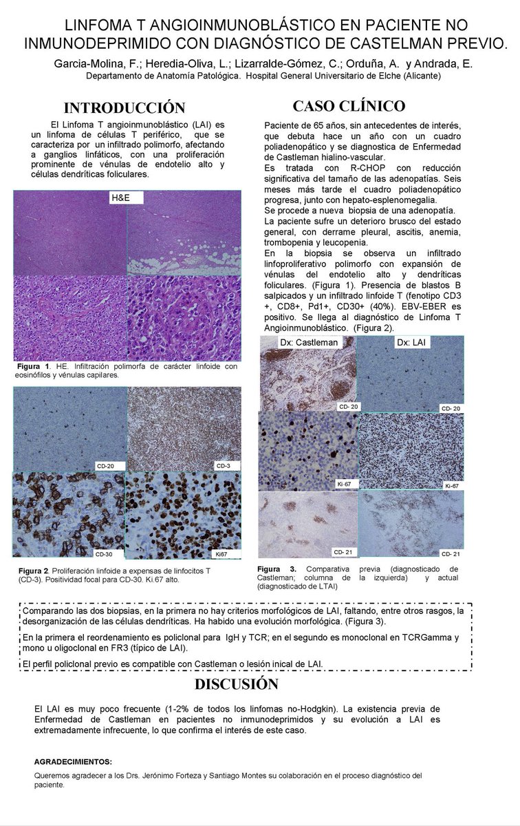 SEAP_IAP's tweet photo. Garcia-Molina F y col. Sesión pósteres. Reunión Anual @SEAP_IAP #SEAP2016 #AnatomiaPatologica. #hemapath https://t.co/20uVRUR8Pv