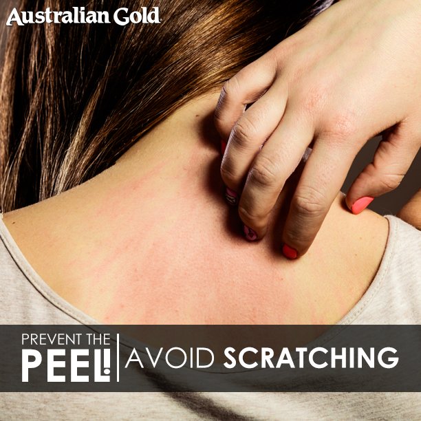 AustralianGold_SA tweet media